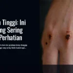 Gula Darah Tinggi: Ini 6 Tanda yang Sering Lolos dari Perhatian